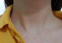 长在哪里的痣是贵人痣