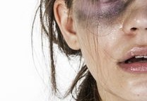 女人面部痣相技巧