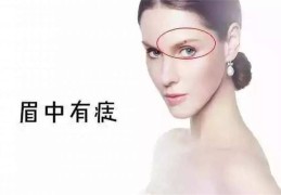 ​象征财富的痣长在哪里