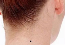 男人及女人脖子后有痣哪个命好
