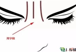 ​面部川字纹的人命好吗