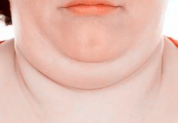 女人脖子粗命好吗