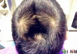 头顶几个旋代表什么