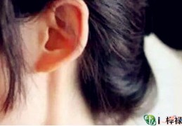 女人是招风耳命好吗