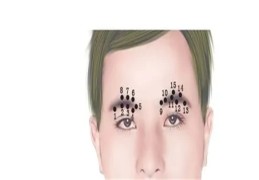 眉毛上的痣代表什么