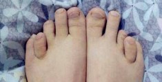 从脚趾长度看命运解析