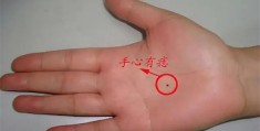 手背长痣好还是手心长痣好