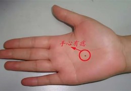 手背长痣好还是手心长痣好