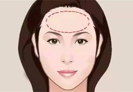 天庭饱满的女人的命运