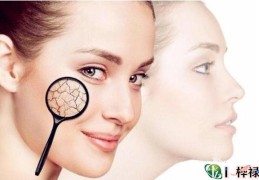 皮肤粗造的女人命好吗