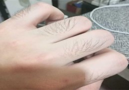 手指长毛代表什么